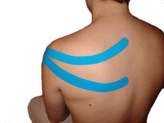 Kinesio-Taping
