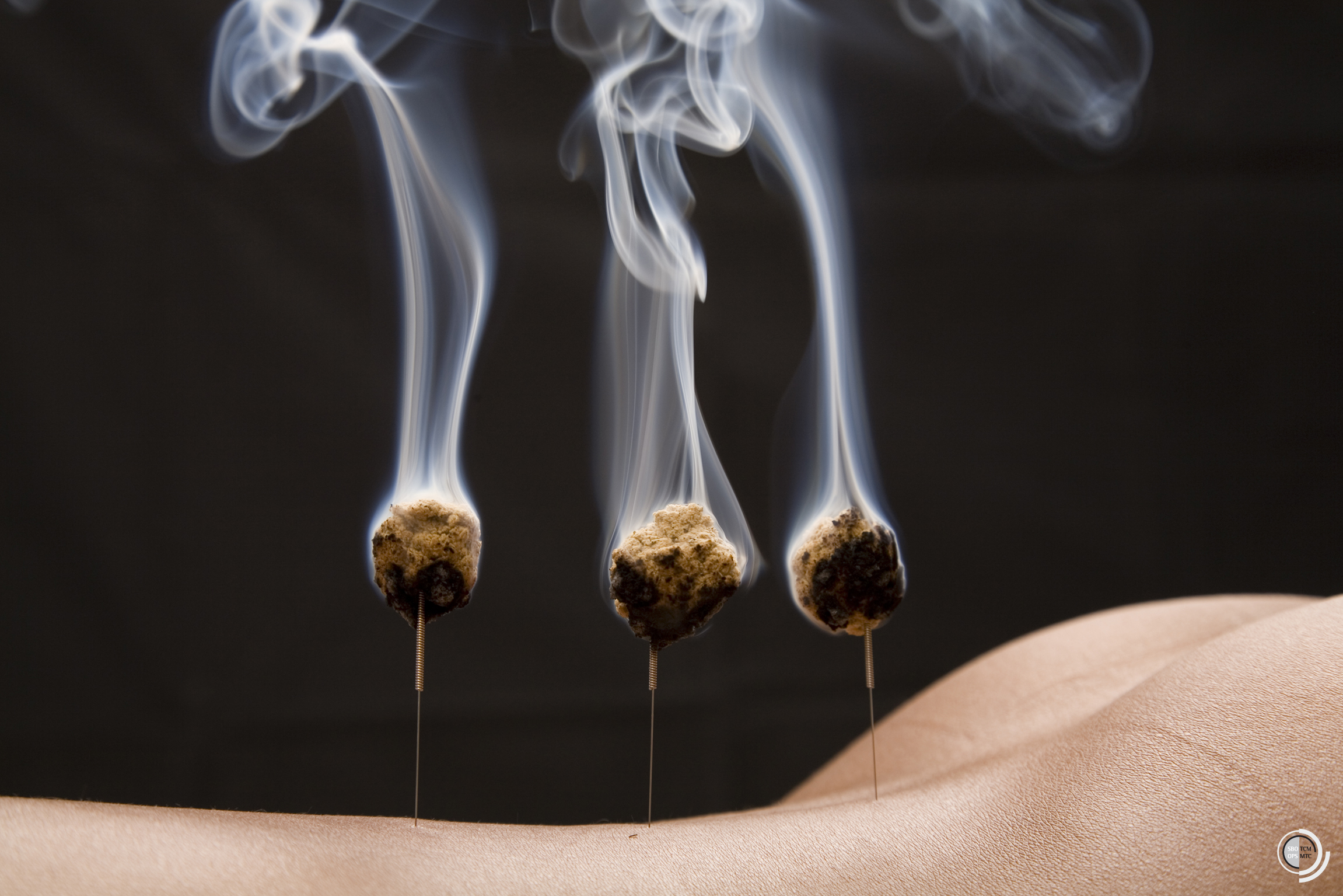Moxibustion
